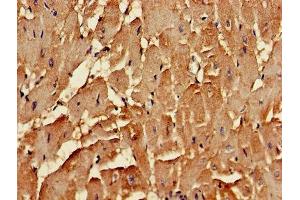 Immunohistochemistry (IHC) image for anti-Clathrin, Heavy Polypeptide Like 1 (CLTCL1) (AA 1423-1566) antibody (ABIN7147850)