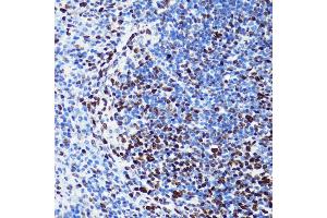 Immunohistochemistry of paraffin-embedded mouse spleen using Acetyl-Histone H2B-K5 antibody (ABIN7267733) at dilution of 1:100 (40x lens). (Histone H2B 抗体  (acLys5))