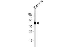 Western Blotting (WB) image for anti-Interferon Regulatory Factor 2 Binding Protein 2 (IRF2BP2) antibody (ABIN3004746) (IRF2BP2 抗体)