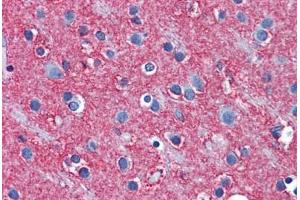 Immunohistochemistry (Formalin-fixed Paraffin-embedded Sections) (IHC (fp)) image for anti-Solute Carrier Family 1 (Glial High Affinity Glutamate Transporter), Member 2 (SLC1A2) (AA 467-516) antibody (ABIN6746998)