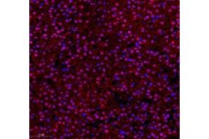 Immunofluorescence of paraffin embedded rat adrenal gland using ZNF295 (ABIN7076264) at dilution of 1: 650 (250x lens) (ZNF295 抗体)