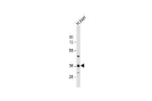 Anti-C6orf58 Antibody (Center) at 1:1000 dilution + human liver lysate Lysates/proteins at 20 μg per lane. (C6ORF58 抗体  (AA 205-233))