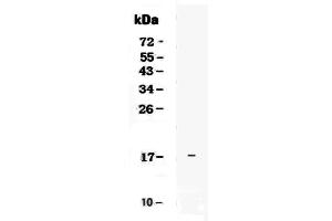 Western blot analysis of IL17E using anti-IL17E antibody . (IL-25 抗体  (AA 33-177))