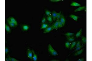 Immunofluorescent analysis of Hela cells using ABIN7154376 at dilution of 1:100 and Alexa Fluor 488-congugated AffiniPure Goat Anti-Rabbit IgG(H+L) (GRHL2 抗体  (AA 1-265))