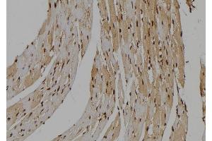 ABIN6263656 and ABIN6277487 at 1/100 staining Mouse heart tissue by IHC-P. (Nemo-Like Kinase 抗体  (N-Term))