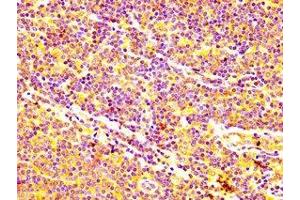 Immunohistochemistry (IHC) image for anti-ATP-Binding Cassette, Sub-Family C (CFTR/MRP), Member 5 (ABCC5) (AA 455-566) antibody (ABIN7160318)