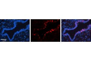 Rabbit Anti-XPOT Antibody     Formalin Fixed Paraffin Embedded Tissue: Human Bronchial Epithelial Tissue  Observed Staining: Cytoplasmic and nuclear  Primary Antibody Concentration: 1:100  Other Working Concentrations: 1/600  Secondary Antibody: Donkey anti-Rabbit-Cy3  Secondary Antibody Concentration: 1:200  Magnification: 20X  Exposure Time: 0. (XPOT 抗体  (Middle Region))