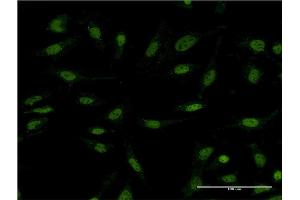 Immunofluorescence of monoclonal antibody to DIDO1 on HeLa cell. (DIDO1 抗体  (AA 321-420))