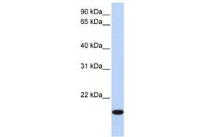 EVX2 antibody used at 0. (EVX2 抗体  (N-Term))
