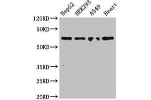 Western Blot Positive WB detected in: HepG2 whole cell lysate, HEK293 whole cell lysate, A549 whole cell lysate, Mouse heart tissue All lanes: TRIM5 antibody at 3 μg/mL Secondary Goat polyclonal to rabbit IgG at 1/50000 dilution Predicted band size: 57, 47, 41, 38, 32, 30 kDa Observed band size: 70 kDa (TRIM5 抗体  (AA 1-493))