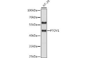 Western blot analysis of extracts of HT-29 cells, using PTOV1 antibody (ABIN7269578) at 1:1000 dilution.