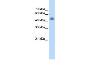 WB Suggested Anti-PRPF19 Antibody Titration:  1. (PRP19 抗体  (N-Term))