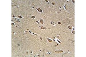 NGFR antibody immunohistochemistry analysis in formalin fixed and paraffin embedded human brain tissue.