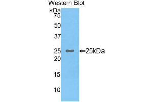 Western Blotting (WB) image for anti-Osteoclast Stimulating Factor 1 (OSTF1) (AA 12-214) antibody (ABIN1860106) (OSTF1 抗体  (AA 12-214))