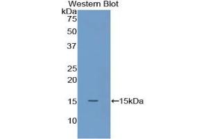 Detection of Recombinant S100A9, Mouse using Polyclonal Antibody to S100 Calcium Binding Protein A9 (S100A9) (S100A9 抗体  (AA 1-113))