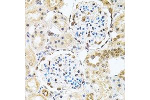 Immunohistochemistry of paraffin-embedded rat kidney using PNKP antibody.
