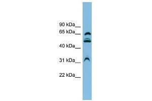 WDR1 antibody used at 1 ug/ml to detect target protein. (WDR1 抗体  (N-Term))
