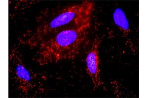 Proximity Ligation Assay (PLA) image for anti-FYN Oncogene Related To SRC, FGR, YES (FYN) (AA 1-537) antibody (ABIN515873)