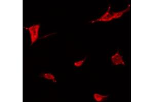 ABIN6266806 staining COLO205 by IF/ICC. (Meningioma 1 抗体  (Internal Region))
