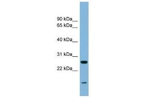 TRAPPC4 antibody used at 0. (TRAPPC4 抗体  (Middle Region))