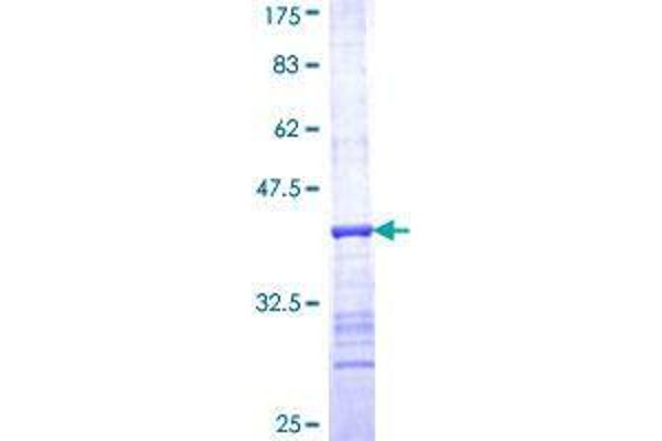 Ribonuclease H1 Protein (RNASEH1) (AA 189-286) (GST tag)