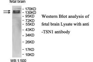Image no. 1 for anti-Intersectin 1 (ITSN1) antibody (ABIN1577370) (ITSN1 抗体)