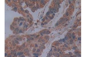 Used in DAB staining on fromalin fixed paraffin- embedded breast cancer tissue (Cadherin 4 抗体  (AA 667-916))