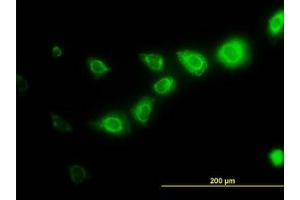 Image no. 2 for anti-Calpain, Small Subunit 1 (CAPNS1) (AA 172-260) antibody (ABIN598500) (Calpain S1 抗体  (AA 172-260))