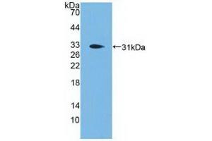 Detection of Recombinant PCSK1, Human using Polyclonal Antibody to Proprotein Convertase Subtilisin/Kexin Type 1 (PCSK1) (PCSK1 抗体  (AA 500-738))
