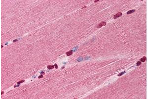 Human Skeletal Muscle (formalin-fixed, paraffin-embedded) stained with TIRAP antibody ABIN297782 at 10 ug/ml followed by biotinylated goat anti-rabbit IgG secondary antibody ABIN481713, alkaline phosphatase-streptavidin and chromogen. (TIRAP 抗体  (N-Term))