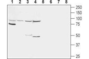 Western blot analysis of rat kidney (lanes 1 and 5), rat liver (lanes 2 and 6), mouse liver (lanes 3 and 7) and human HepG2 liver carcinoma cell line (lanes 4 and 8) lysates:  - 1-4. (Glucagon Receptor 抗体  (1st Extracellular Loop))