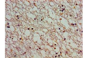 Immunohistochemistry of paraffin-embedded human brain tissue using ABIN7146404 at dilution of 1:100 (ATP2C1 抗体  (AA 491-605))