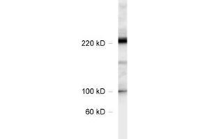 dilution: 1 : 1000, sample: rat hippocampus lysate (CACNA1B 抗体  (AA 1921-2222))