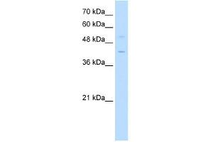 WB Suggested Anti-KLF1 Antibody Titration: 0. (KLF1 抗体  (Middle Region))