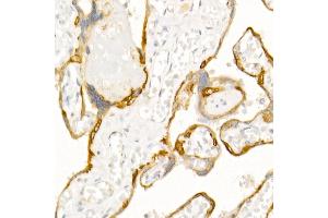 Immunohistochemistry (IHC) image for anti-Keratin 19 (KRT19) (AA 241-400) antibody (ABIN3020779)