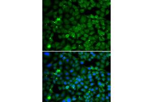 Immunofluorescence analysis of MCF-7 cells using SMYD4 antibody. (SMYD4 抗体  (AA 1-260))