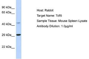 Host: Rabbit Target Name: Tcfl5 Sample Type: Mouse Spleen lysates Antibody Dilution: 1. (TCFL5 抗体  (N-Term))