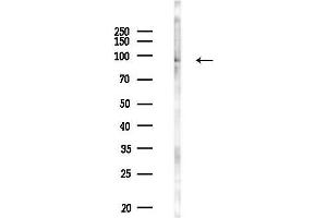 Western blot analysis of lysates from PC12 cells(LPS 4h treatment), using PATL1 Antibody at 1/1000 dilution.