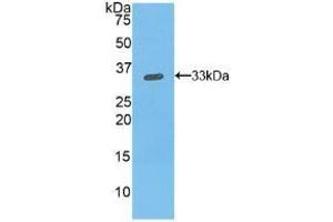 Detection of Recombinant ITGb1, Mouse using Polyclonal Antibody to Integrin Beta 1 (ITGb1) (ITGB1 抗体  (AA 454-714))