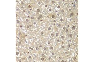 Immunohistochemistry of paraffin-embedded mouse liver using MAD1L1 antibody. (MAD1L1 抗体  (AA 360-700))