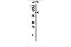 Image no. 1 for anti-RAR-Related Orphan Receptor A (RORA) antibody (ABIN356632)