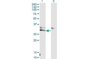 Western Blot analysis of VWF expression in transfected 293T cell line by VWF monoclonal antibody (M02), clone 1A11. (VWF 抗体  (AA 1-273))