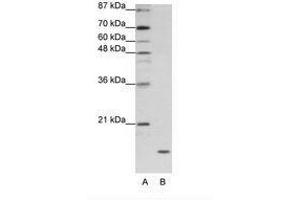 Image no. 1 for anti-Apolipoprotein O (APOO) (C-Term) antibody (ABIN202055)