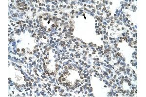 NKD1 antibody was used for immunohistochemistry at a concentration of 4-8 ug/ml to stain Alveolar cells (arrows) in Human Lung. (NKD1 抗体)