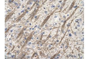 Rabbit Anti-ZNF74 antibody        Paraffin Embedded Tissue:  Human Brain cell   Cellular Data:  Epithelial cells of renal tubule  Antibody Concentration:   4. (ZNF74 抗体  (Middle Region))