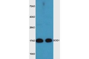 Mouse brain lysates probed with Rabbit Anti-SOD1 Polyclonal Antibody, Unconjugated  at 1:3000 for 90 min at 37˚C. (SOD1 抗体  (AA 6-100))