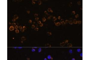 Immunofluorescence analysis of Jurkat cells using KLRC4 Polyclonal Antibody at dilution of 1:100 (40x lens). (KLRC4 抗体)