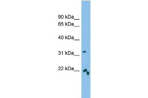 WB Suggested Anti-MCART6 Antibody Titration: 0. (MCART6 抗体  (Middle Region))