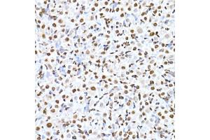 Immunohistochemistry of paraffin-embedded rat ovary using RBM3 Rabbit mAb (ABIN7270084) at dilution of 1:25 (40x lens). (RBM3 抗体)