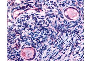 Anti-TMEM5 antibody IHC of human ovary, oocytes. (TMEM5 抗体  (Extracellular Domain))